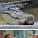 Pics: Severed Human Arm In Croc's Mouth/Arm Reattached