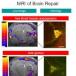 MRI images of genes in action in the living brain